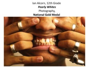 Scholastic Winner "Pearly Whites"